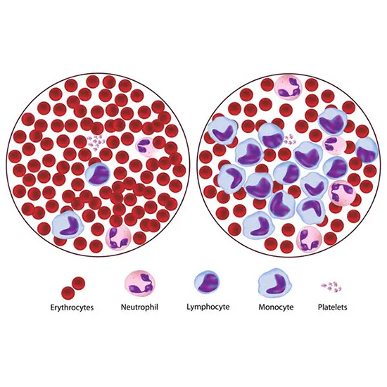 ALL Multiplex PCR Basic